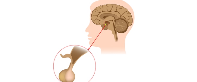 الغدة النخامية 