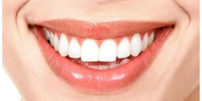 تعرفي على أفضل 5 أطعمة وطرق منزلية لتبييض الأسنان