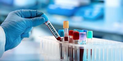 ابتكار اختبار دم بسيط يمكنه التنبؤ بموعد ولادة المرأة قبل أيام