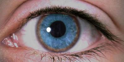 ما هو مرض ويلسون.. أعراضه ومضاعفاته