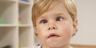 كسل العين للطفل!