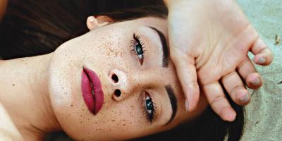 تعرفي على أسباب ظهور النمش الأبيض على ذراعيك وطرق التخلص منه