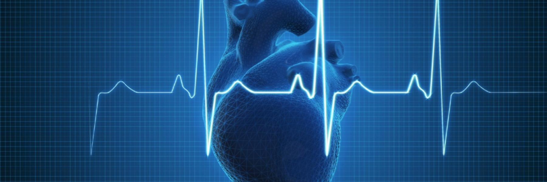 الاستئصال الجراحي أكثر فعالية من العقاقير في علاج اضطراب النَّظْم القلبي الشائع