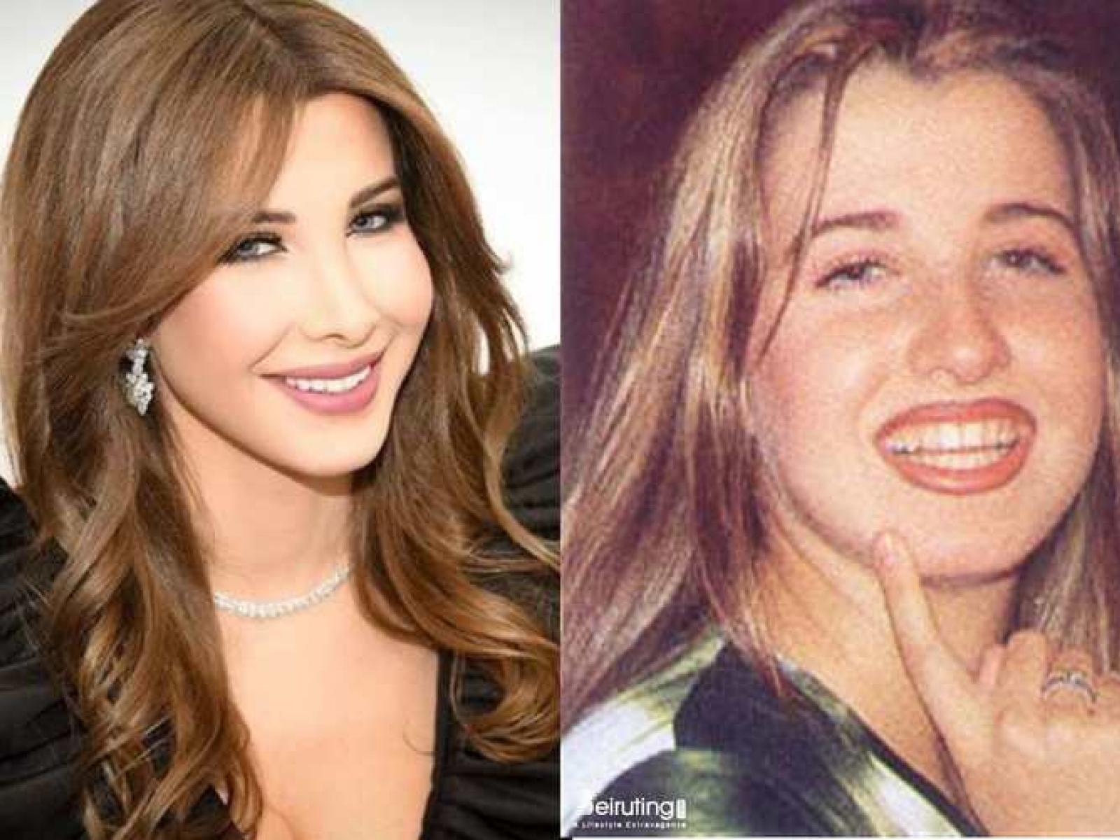 Nancy ajram before surgery