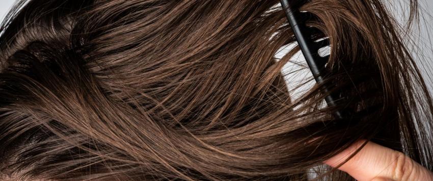 احذري.. هذه الأطعمة تسبب الشعر الدهني وأخرى تمنعه