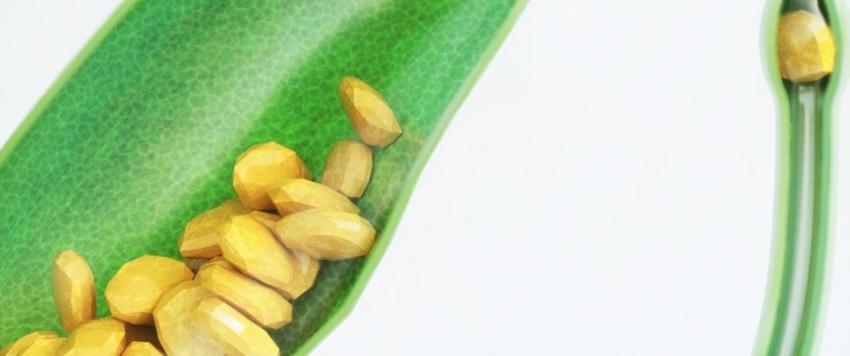 الحصوة المرارية