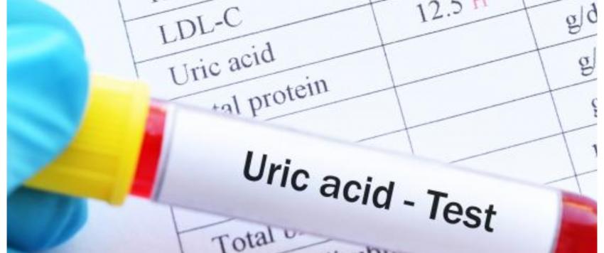 حمض اليوريك