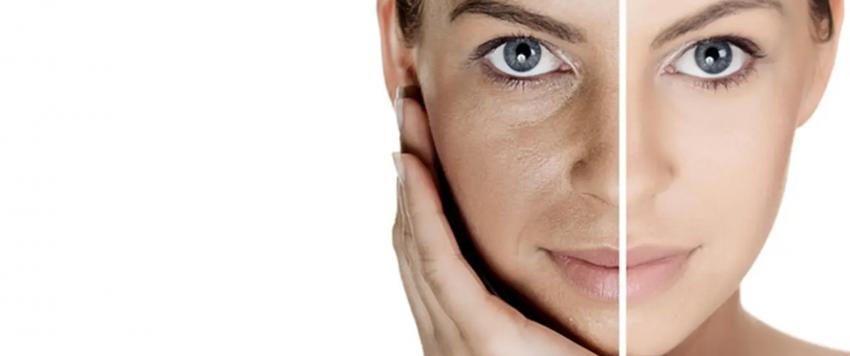 تصبغات الجلد