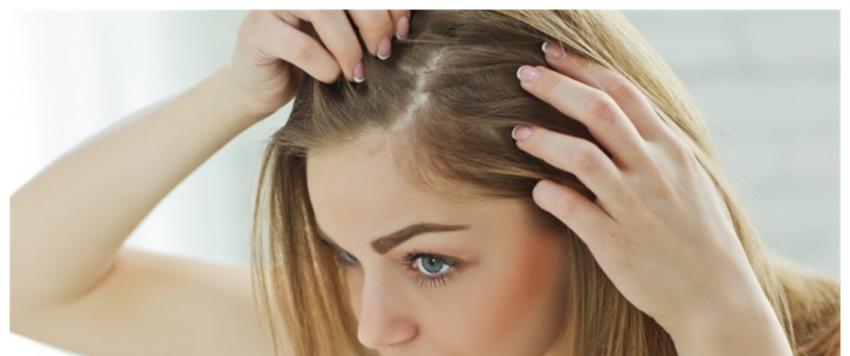 دمامل الرأس