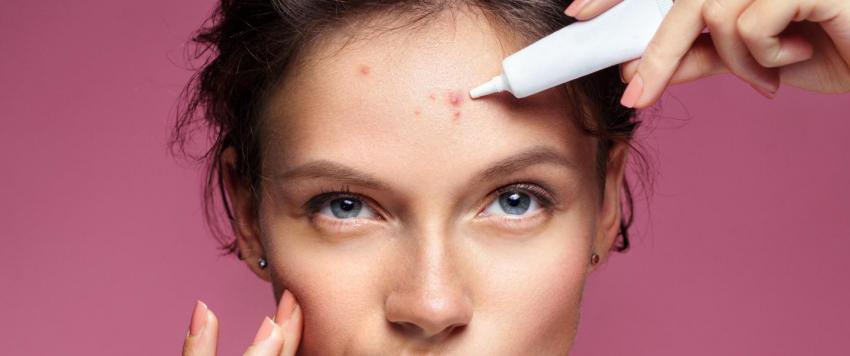 كيف تُخفي أي نوع من أنواع البثور؟ 