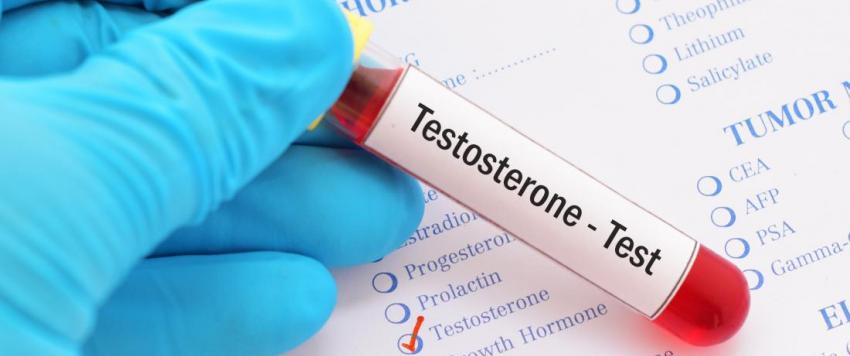 هرمون التستوستيرون