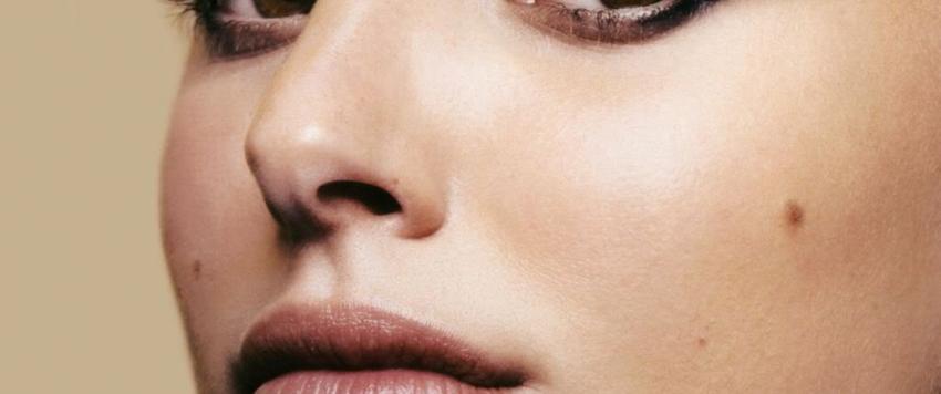 5 علاجات طبيعية فعالة لإزالة شامة الوجه.. تعرف عليها (صور)