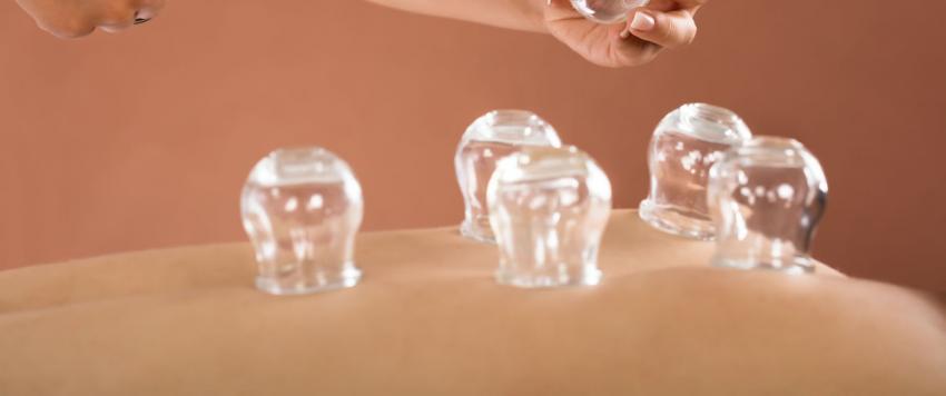 ما هي الحجامة وما فوائدها؟