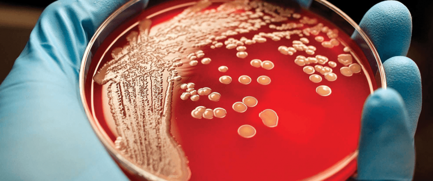 مرض اللوكيميا