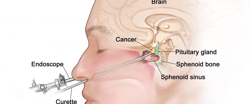 الغدة النخامية 