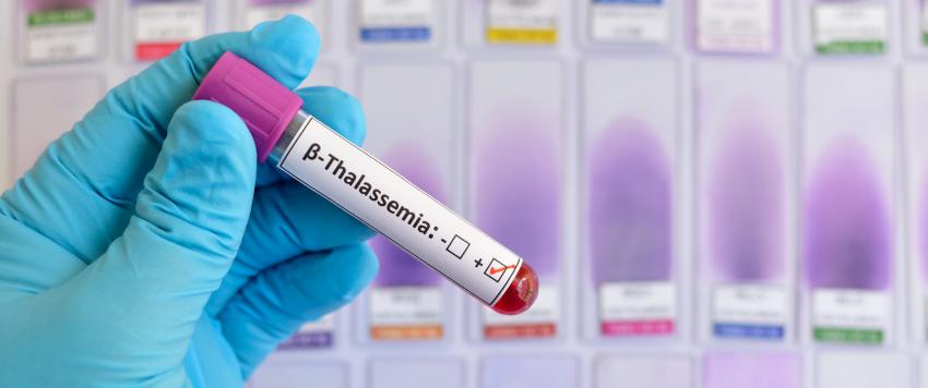 مرض الثلاسيميا