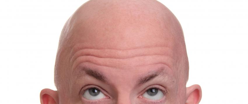 نصائح تمنع تساقط الشعر عند الرجال.. تعرف عليها