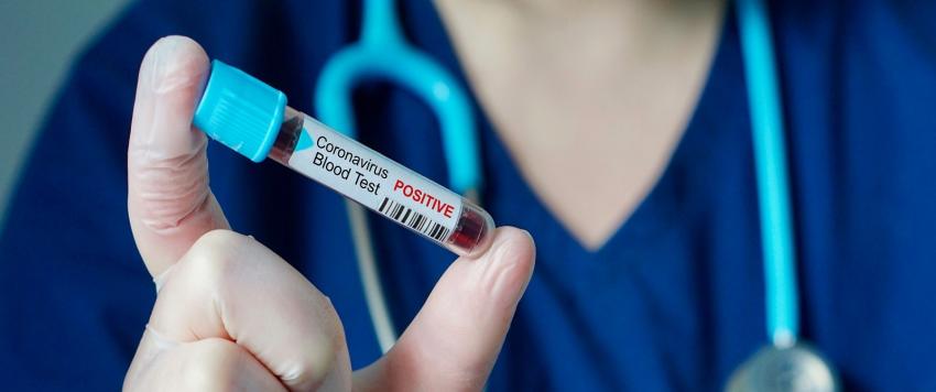 5 أدوات صحية يجب الاحتفاظ بها في المنزل بسبب وباء كورونا