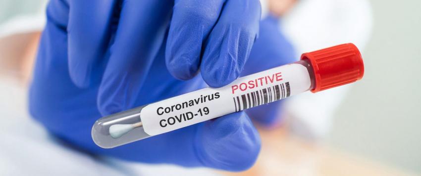 ابتكار اختبار يكشف كورونا في المنزل ببساطة