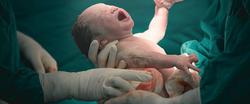 الولادة المبكرة