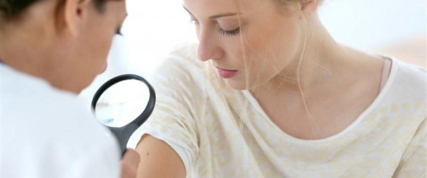 علاجات منزلية للتخلص من الأورام الشحمية.. تعرف عليها