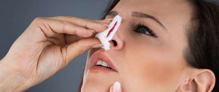 كيف تعاملين مع نزيف الأنف أو الرعاف!