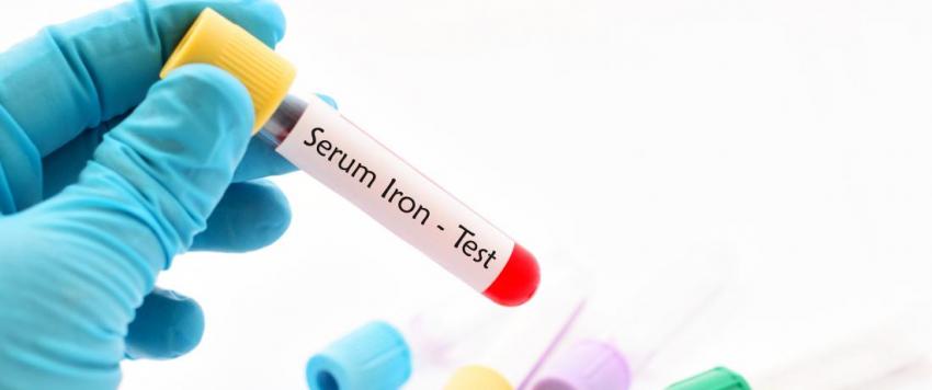 الأطعمة الغنية بالحديد