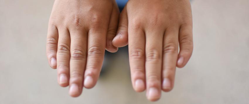 ما الذي يجعل الشخص أعسر أو أيمن؟