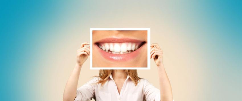 تبييض الأسنان